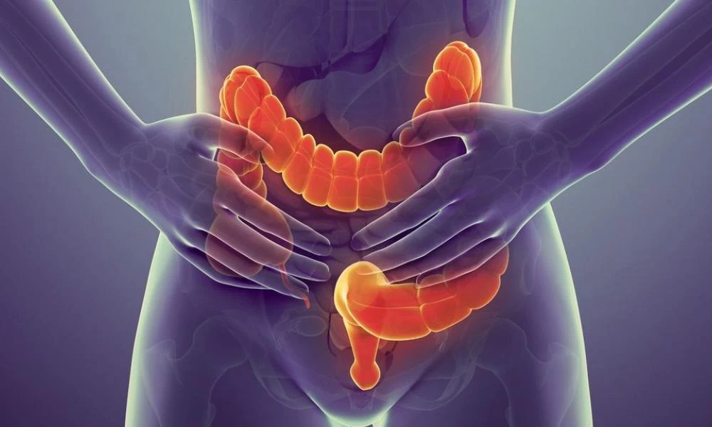 Καρκίνος του παχέος εντέρου: Τα συμπτώματα που θέλουν προσοχή